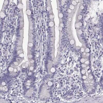 Immunohistochemistry-Paraffin: GCAP1 Antibody [NBP2-55158]