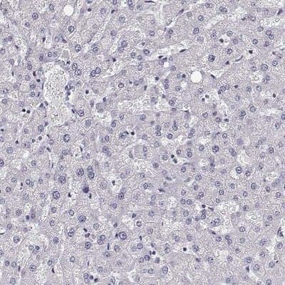 Immunohistochemistry-Paraffin: GCAP1 Antibody [NBP2-55158]