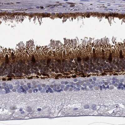 Immunohistochemistry-Paraffin: GCAP1 Antibody [NBP3-17717]