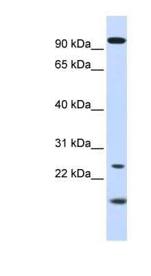 Western Blot: GCAP1 Antibody [NBP1-54868]