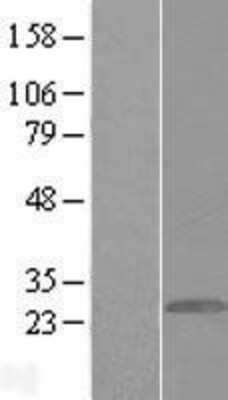 Western Blot: GCAP1 Overexpression Lysate [NBL1-11406]