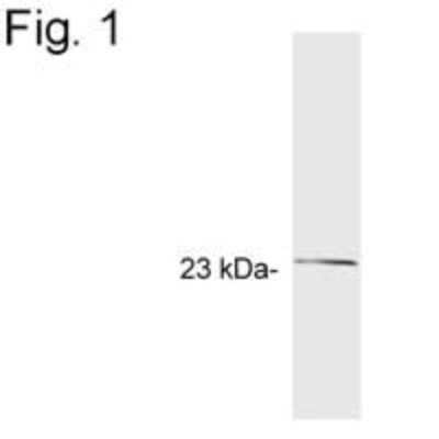 Western Blot: GCAP2 Antibody (A1)BSA Free [NB120-5422]