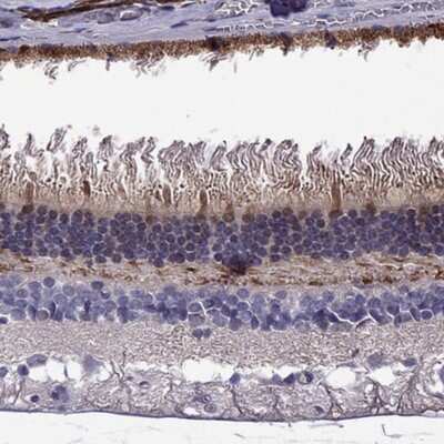 Immunohistochemistry-Paraffin: GCAP2 Antibody [NBP2-68721]