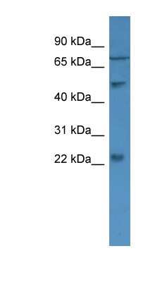 Western Blot: GCAP2 Antibody [NBP1-79774]