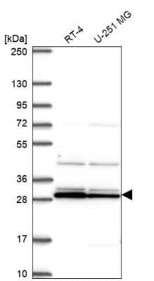 Western Blot: GCAP2 Antibody [NBP2-68721]