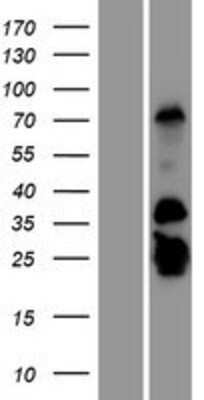 Western Blot: GCAP2 Overexpression Lysate [NBP2-10804]