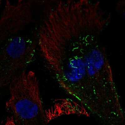 Immunocytochemistry/ Immunofluorescence: GCAP3 Antibody [NBP1-91930]