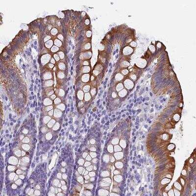 Immunohistochemistry: GCAP3 Antibody [NBP1-91930]