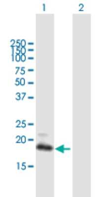 Western Blot: GCAP3 Antibody [H00009626-B01P]