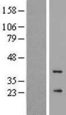 Western Blot: GCAP3 Overexpression Lysate [NBP2-10466]