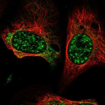 Immunocytochemistry/ Immunofluorescence: GCAT Antibody [NBP1-81564]