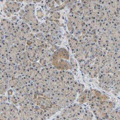 Immunohistochemistry: GCAT Antibody [NBP1-81564]