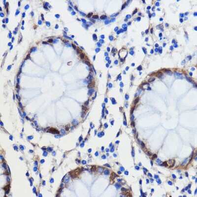 Immunohistochemistry-Paraffin: GCAT Antibody - Azide and BSA Free [NBP3-04780]