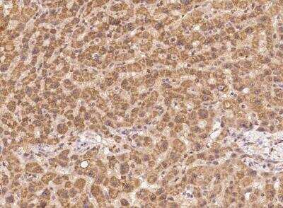 Immunohistochemistry-Paraffin: GCAT Antibody [NBP3-05994]