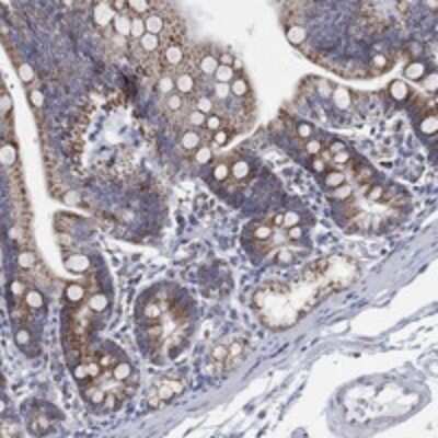 Immunohistochemistry-Paraffin: GCAT Antibody [NBP3-17854]