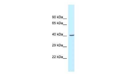 Western Blot: GCAT Antibody [NBP2-82887]