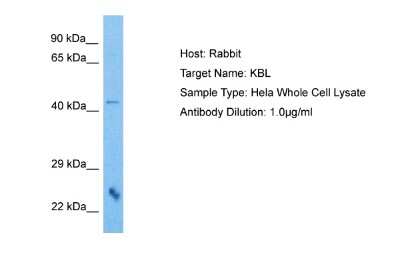 Western Blot: GCAT Antibody [NBP2-82894]