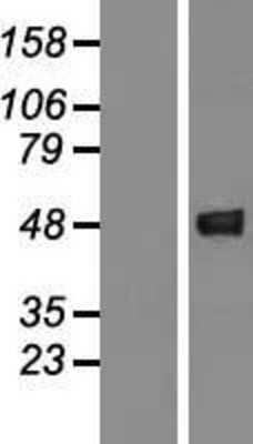 Western Blot: GCAT Overexpression Lysate [NBL1-11001]