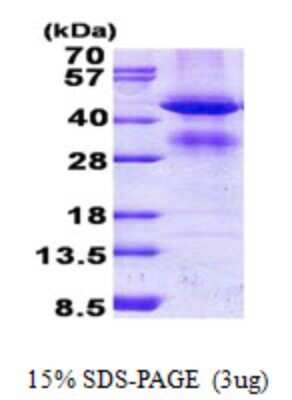 SDS-PAGE: Recombinant Human GCAT His Protein [NBP2-23080]