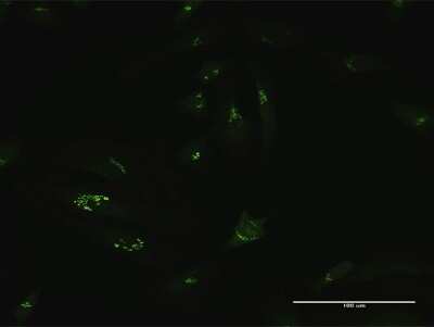 Immunocytochemistry/ Immunofluorescence: GCC1 Antibody [H00079571-B01P]