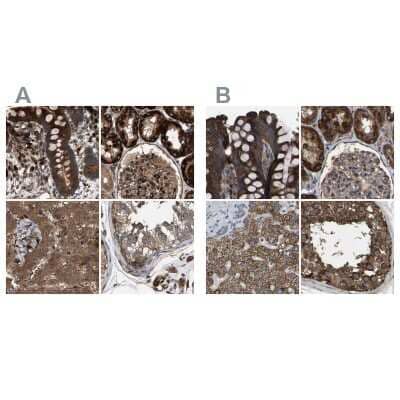 Immunohistochemistry-Paraffin: GCC1 Antibody [NBP1-83609]