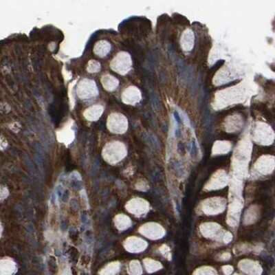 Immunohistochemistry-Paraffin: GCC1 Antibody [NBP1-83610]