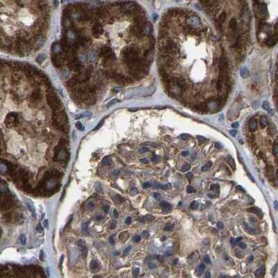 Immunohistochemistry-Paraffin: GCC1 Antibody [NBP1-83610]