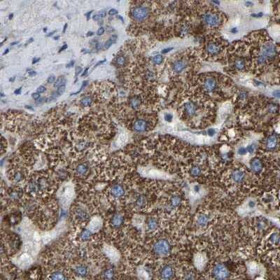 Immunohistochemistry-Paraffin: GCC1 Antibody [NBP1-83610]