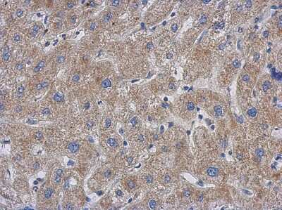 Immunohistochemistry-Paraffin: GCC1 Antibody [NBP2-16621]