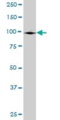 Western Blot: GCC1 Antibody [H00079571-B01P]