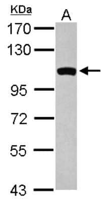 Western Blot: GCC1 Antibody [NBP2-16621]