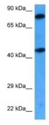 Western Blot: GCC1 Antibody [NBP3-09971]