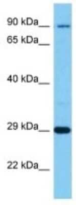 Western Blot: GCC1 Antibody [NBP3-10275]