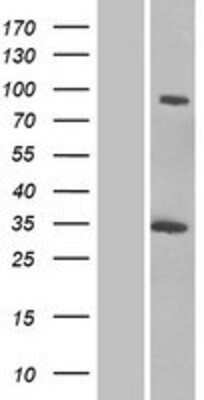 Western Blot: GCC1 Overexpression Lysate [NBP2-06329]