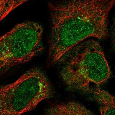 Immunocytochemistry/ Immunofluorescence: GCC185 Antibody [NBP1-89788]