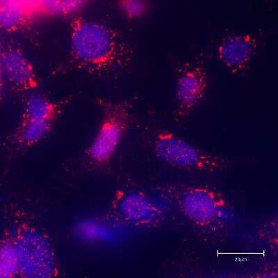 Immunocytochemistry/ Immunofluorescence: GCC185 Antibody [NBP2-04024]