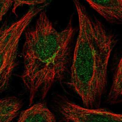 Immunocytochemistry/ Immunofluorescence: GCC185 Antibody [NBP2-38267]