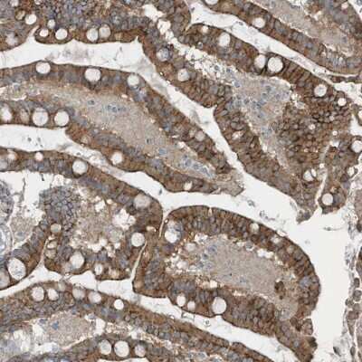 Immunohistochemistry: GCC185 Antibody [NBP2-38267]