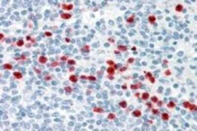 Immunohistochemistry-Paraffin: GCC185 Antibody [NBP1-20922]