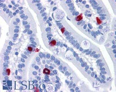 Immunohistochemistry-Paraffin: GCC185 Antibody [NBP1-20922]