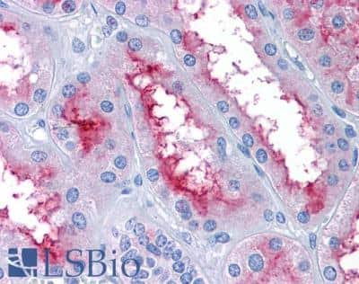 Immunohistochemistry-Paraffin: GCC185 Antibody [NBP1-20922]