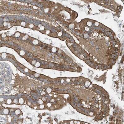 Immunohistochemistry-Paraffin: GCC185 Antibody [NBP1-89788]