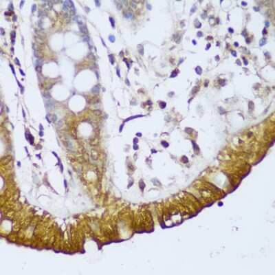 Immunohistochemistry-Paraffin: GCC185 Antibody - Azide and BSA Free [NBP3-03436]