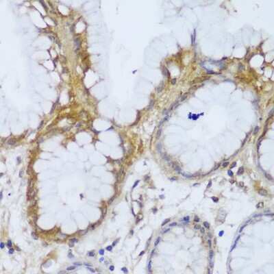 Immunohistochemistry-Paraffin: GCC185 Antibody - Azide and BSA Free [NBP3-03436]
