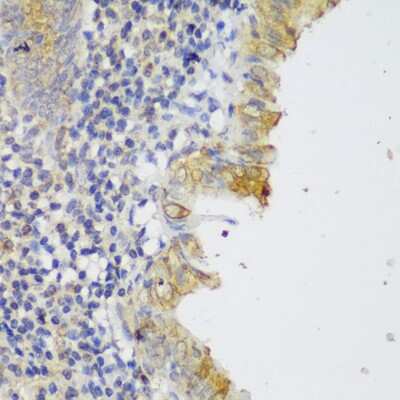Immunohistochemistry-Paraffin: GCC185 Antibody - Azide and BSA Free [NBP3-03436]