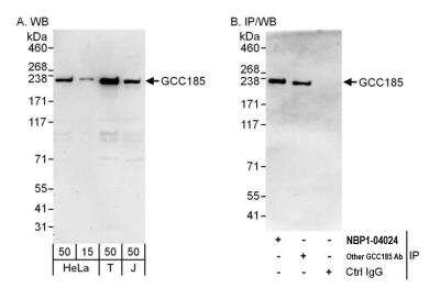 Western Blot: GCC185 Antibody [NBP2-04024]