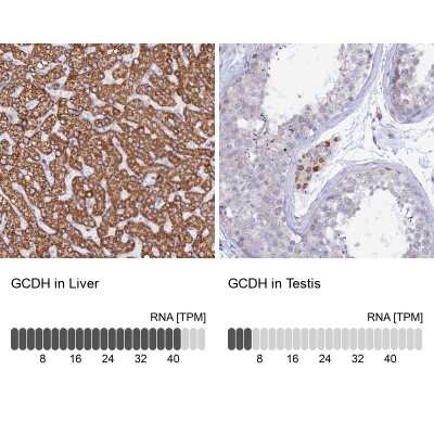 Immunohistochemistry-Paraffin: GCDH Antibody [NBP2-48549]