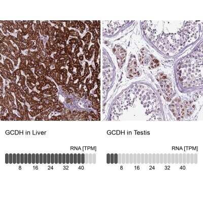 Immunohistochemistry-Paraffin: GCDH Antibody [NBP2-48907]