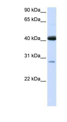 Western Blot: GCDH Antibody [NBP1-54641]