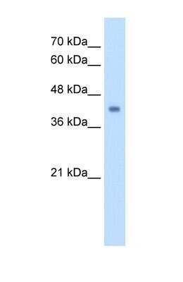 Western Blot: GCDH Antibody [NBP1-54737]